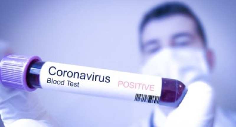 Cách thức điều trị nhiễm virus Corona như thế nào? | Medlatec